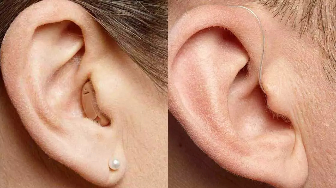 İşitme Cihazı Kulakta Hissedilir mi?